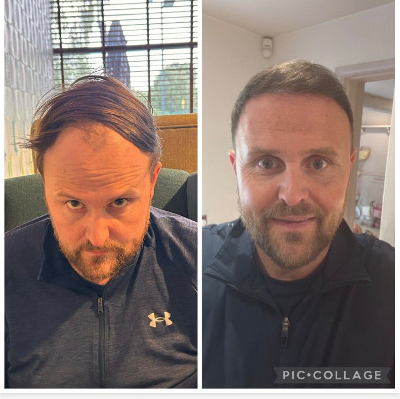 Side-by-side comparison of a man with and without a beard, wearing an Under Armour jacket.
